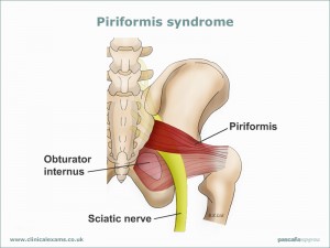 piriformis