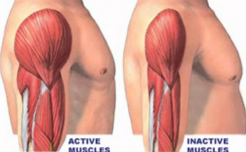 Muscular Dystrophy